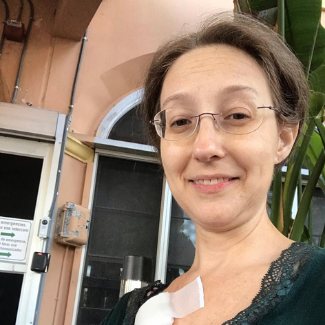 Woman looking at camera with port for breast cancer treatment showing.