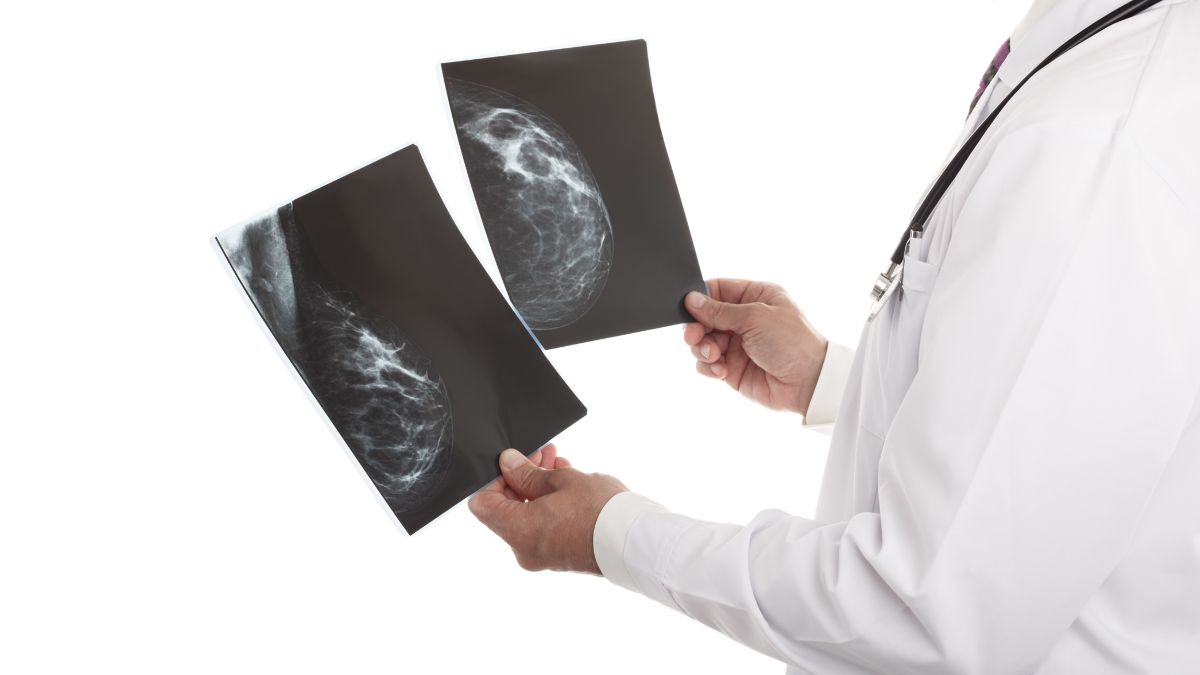 A doctor looks at two mammogram images