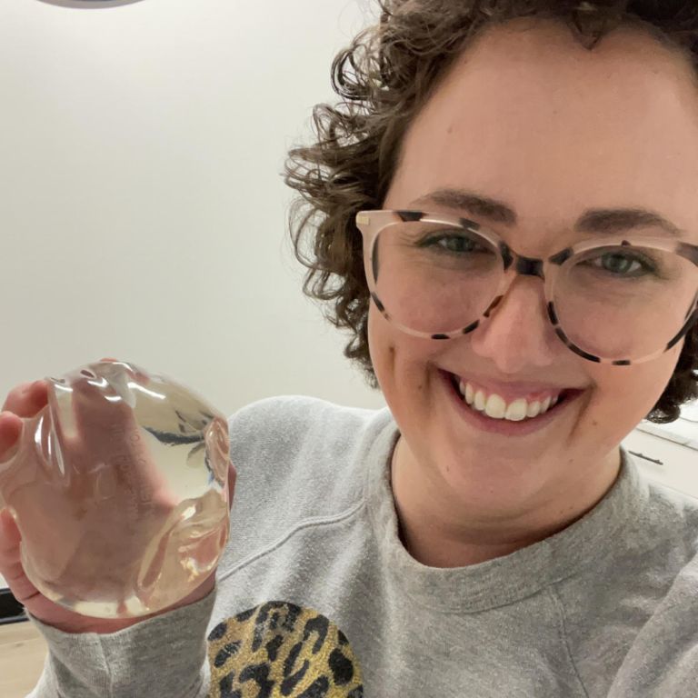 Ashley Walls smiling with a breast implant.