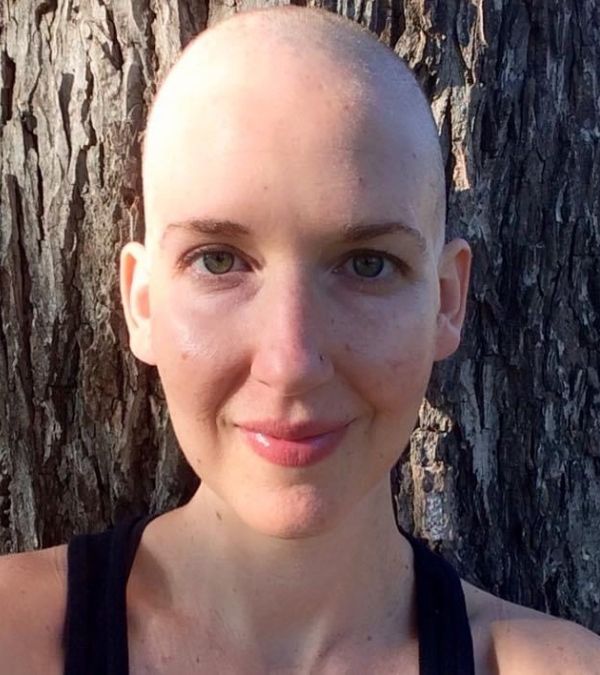 Bethany Adair leans against a tree, her head clean shaven.