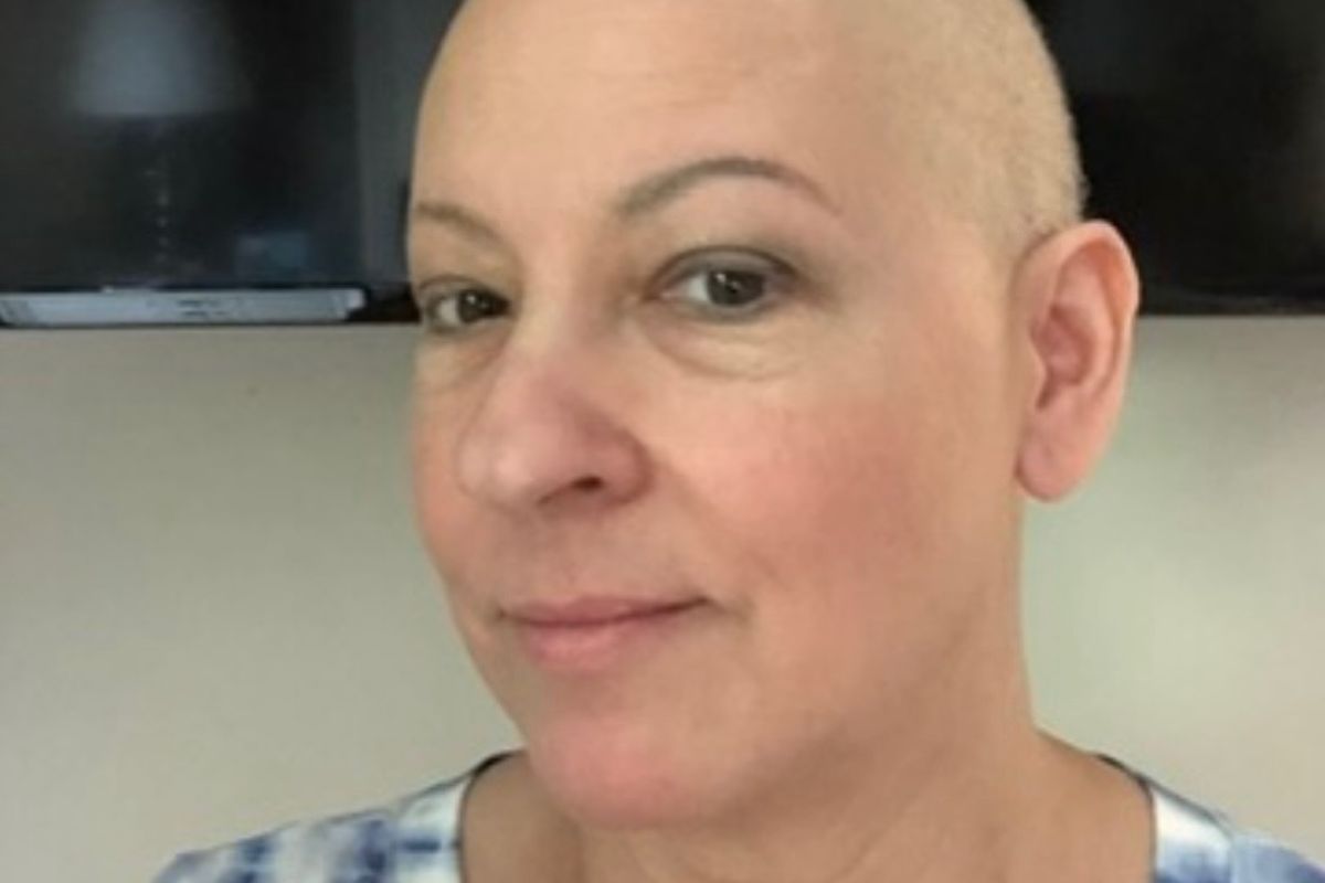 Maria Lleonart sees a little regrowth on her scalp now that she has completed chemotherapy.