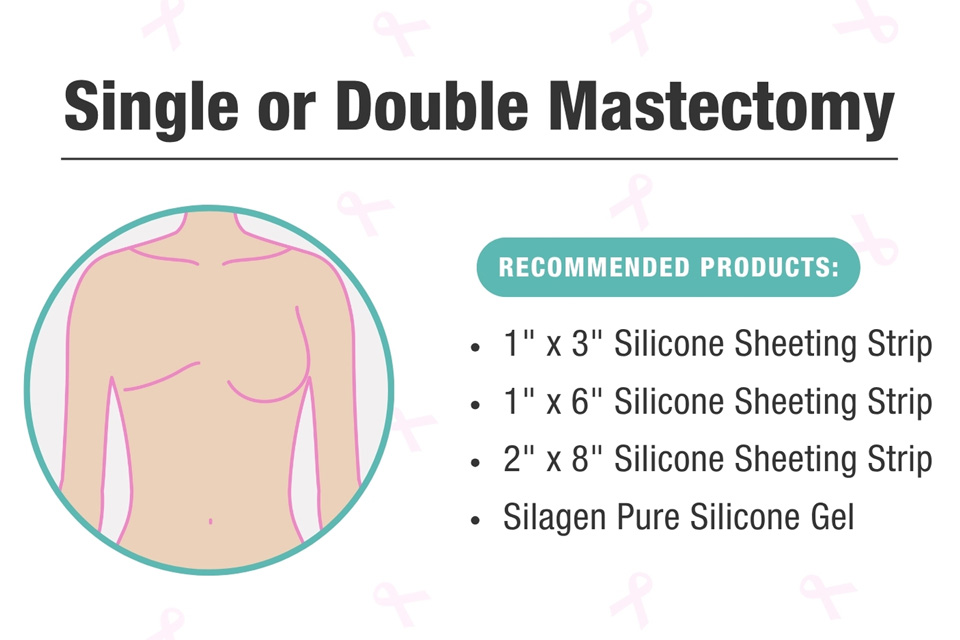Graphic on how to apply silicone strips for a single or double mastectomy