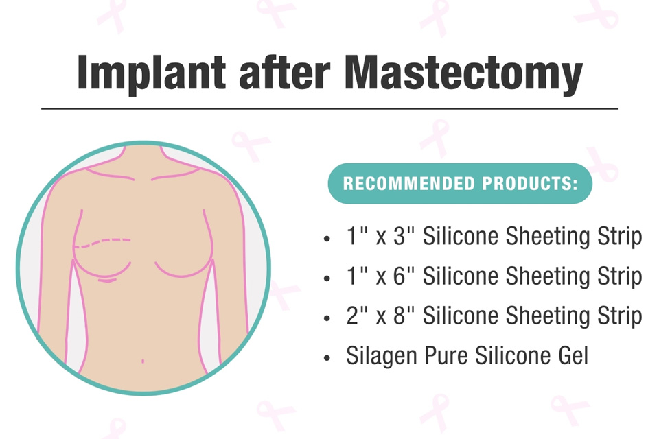 Graphic on how to apply silicone strips for an implant after mastectomy
