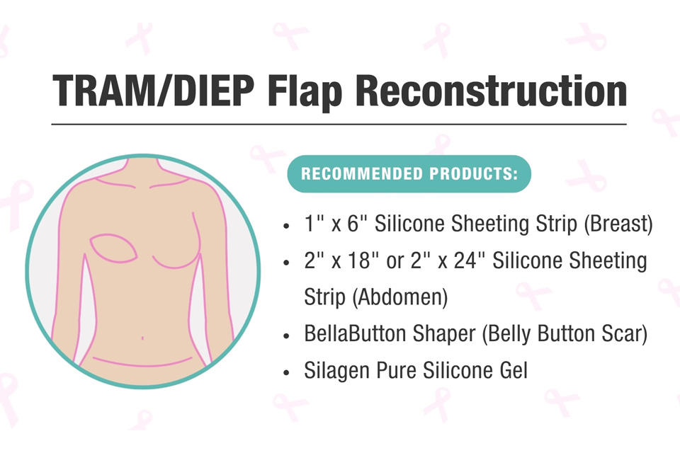 Graphic on how to apply silicone strips for a TRAM/DIEP flap reconstruction