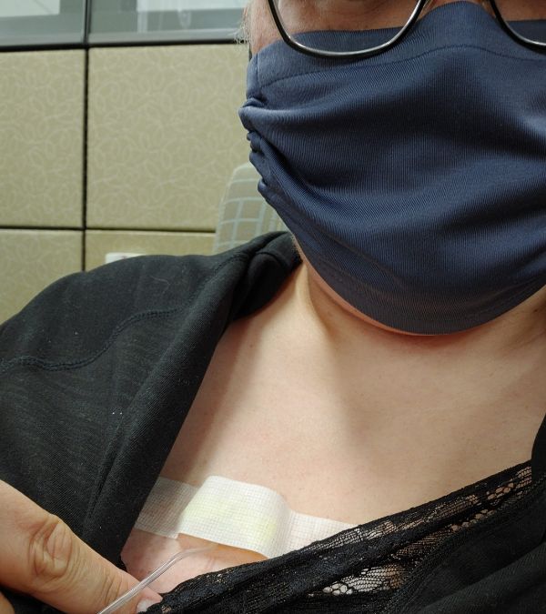 Lisa Walker points to her port-a-cath on her chest.