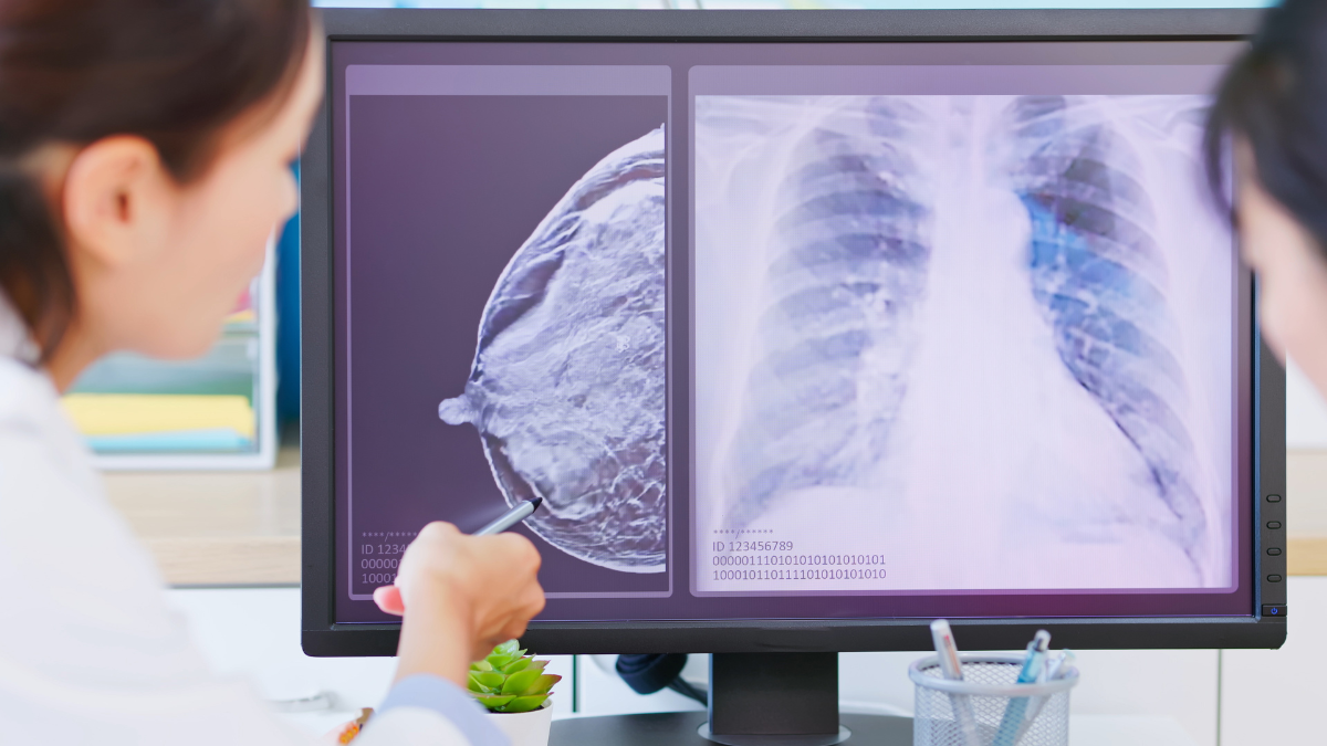 Two women looking at a chest x-ray and a breast mammogram