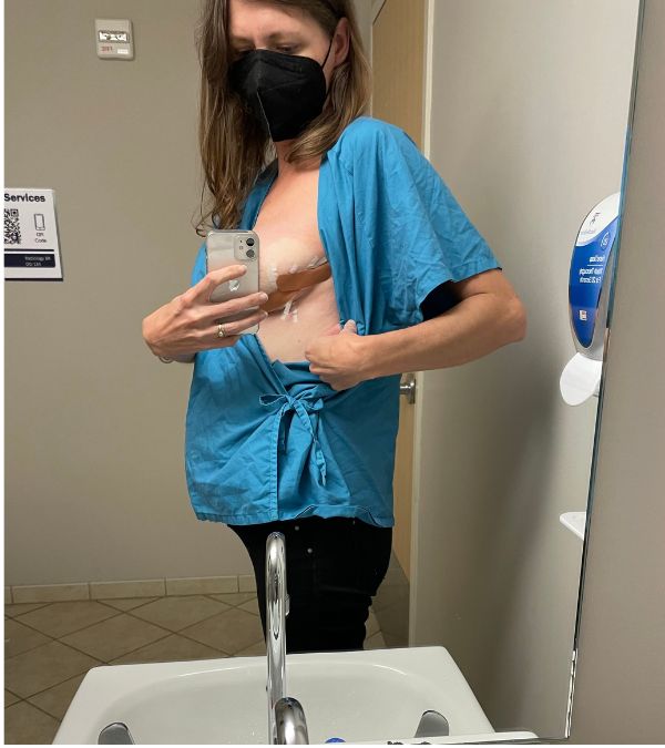After her biopsy, Kim Quick looks at the stitches in the mirror.